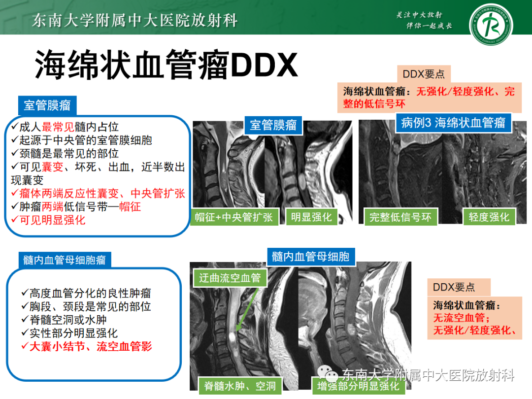 影像PPT - 【PPT】颅颈交界区占位病例随诊-29