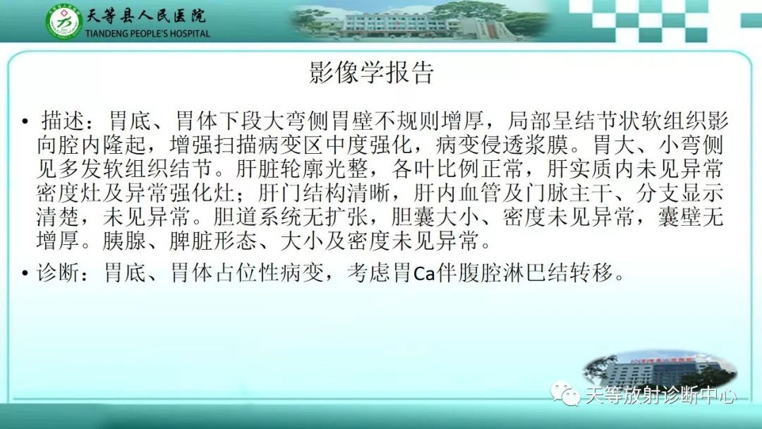 影像PPT - 【PPT】胃淋巴瘤-16