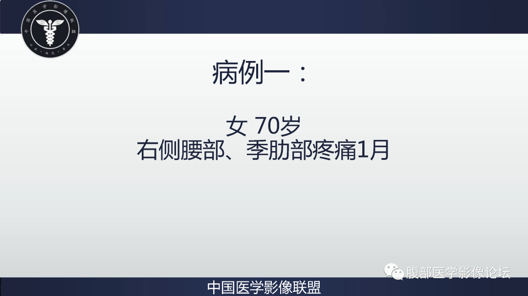 影像PPT - 【病例】肾脏嫌色细胞癌1例CT影像-2