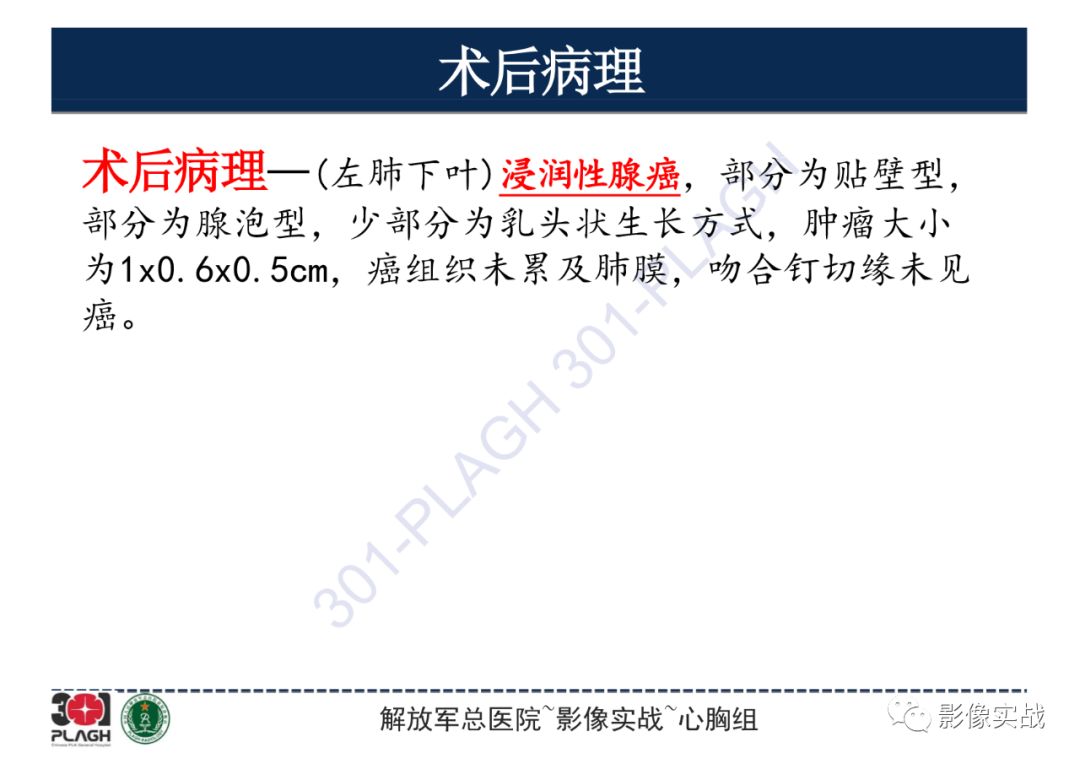 影像PPT - 【病例】肺浸润性腺癌1例CT影像-20