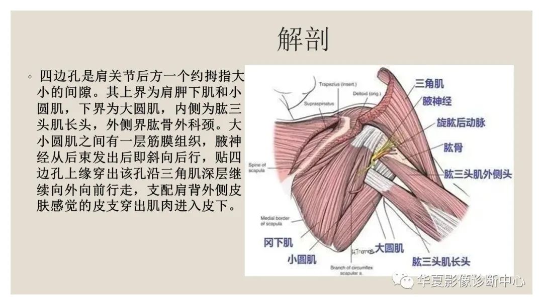 影像PPT - 【PPT】四边孔综合征-3