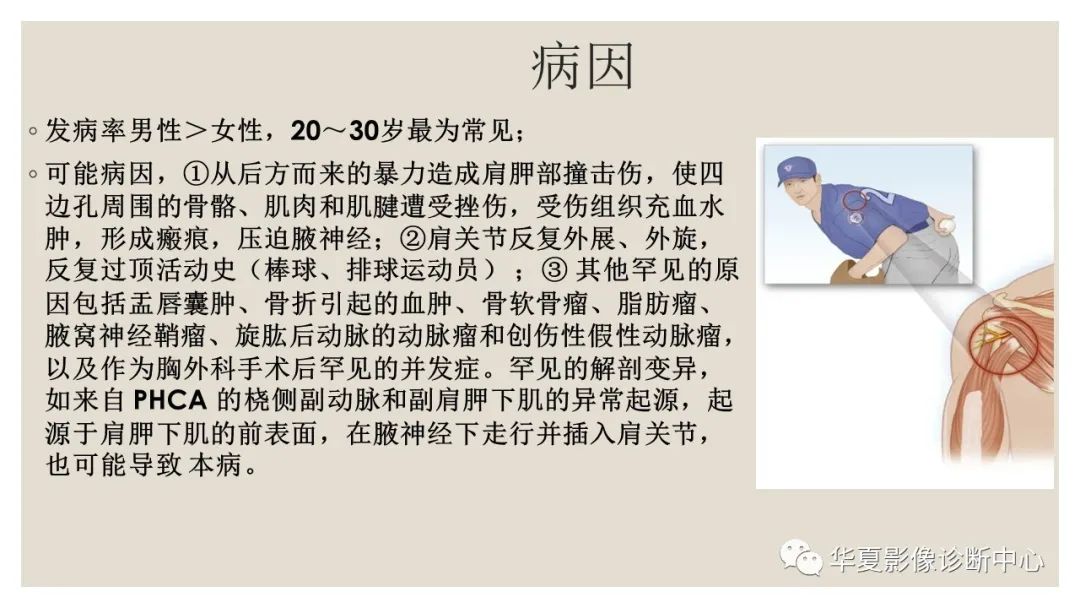 影像PPT - 【PPT】四边孔综合征-5