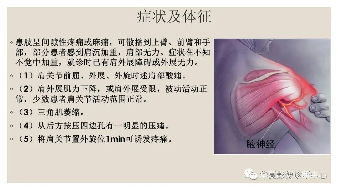 影像PPT - 【PPT】四边孔综合征-6