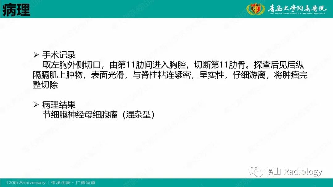 影像PPT - 【病例】纵隔节细胞神经母细胞瘤1例CT及MR-14