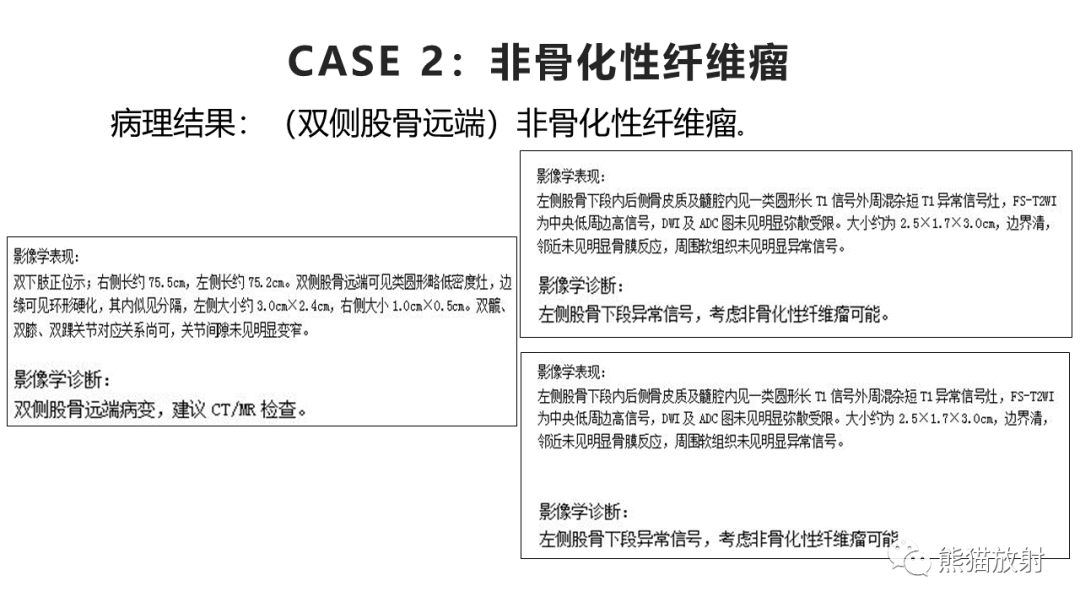 影像PPT - 【病例】长骨非骨化性纤维瘤2例X线CT及MR-24