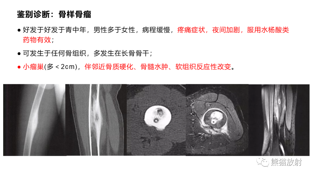 影像PPT - 【病例】长骨非骨化性纤维瘤2例X线CT及MR-35