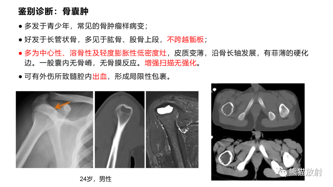 影像PPT - 【病例】长骨非骨化性纤维瘤2例X线CT及MR-32