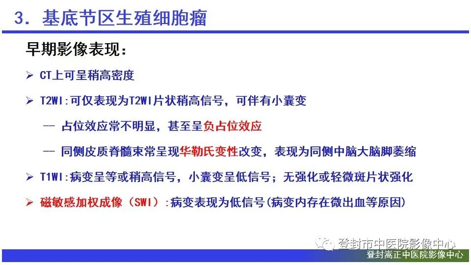 影像PPT - 【PPT】颅内生殖细胞瘤的影像学诊断-17