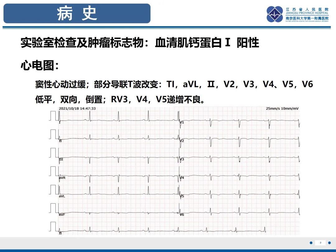 影像PPT - 【PPT】主动脉窦瘤-3