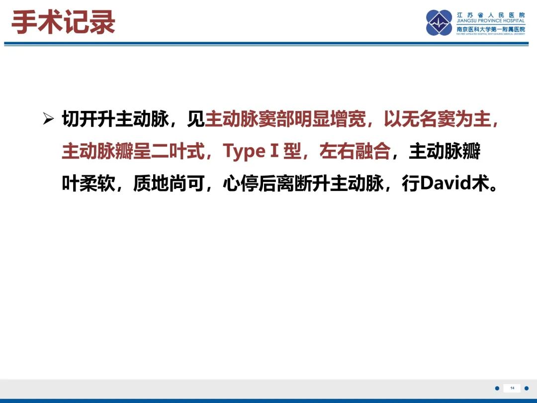 影像PPT - 【PPT】主动脉窦瘤-15