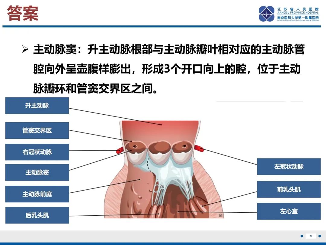 影像PPT - 【PPT】主动脉窦瘤-17