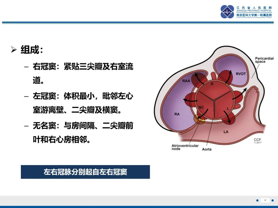 影像PPT - 【PPT】主动脉窦瘤-18