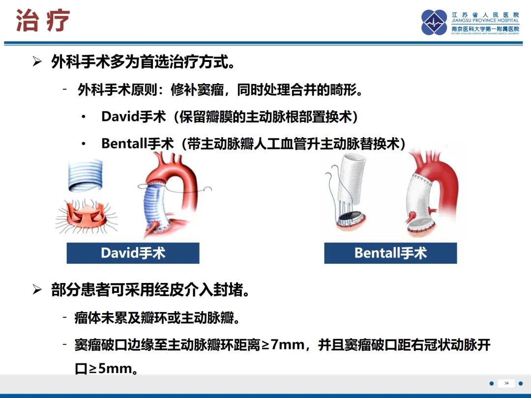 影像PPT - 【PPT】主动脉窦瘤-35