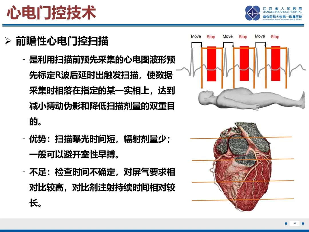 影像PPT - 【PPT】主动脉窦瘤-38