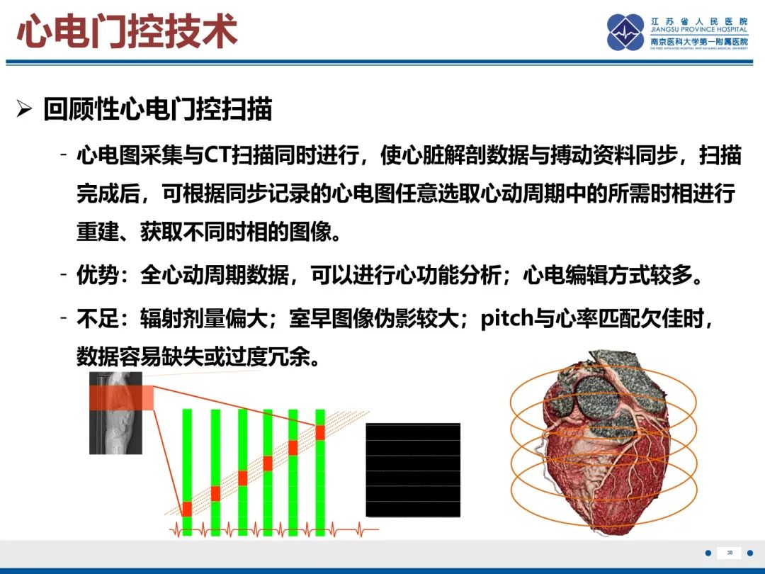 影像PPT - 【PPT】主动脉窦瘤-39