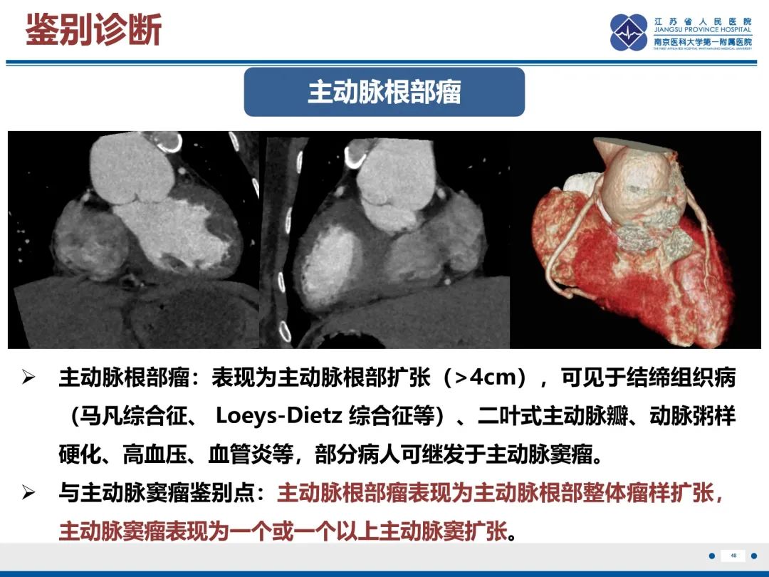 影像PPT - 【PPT】主动脉窦瘤-49