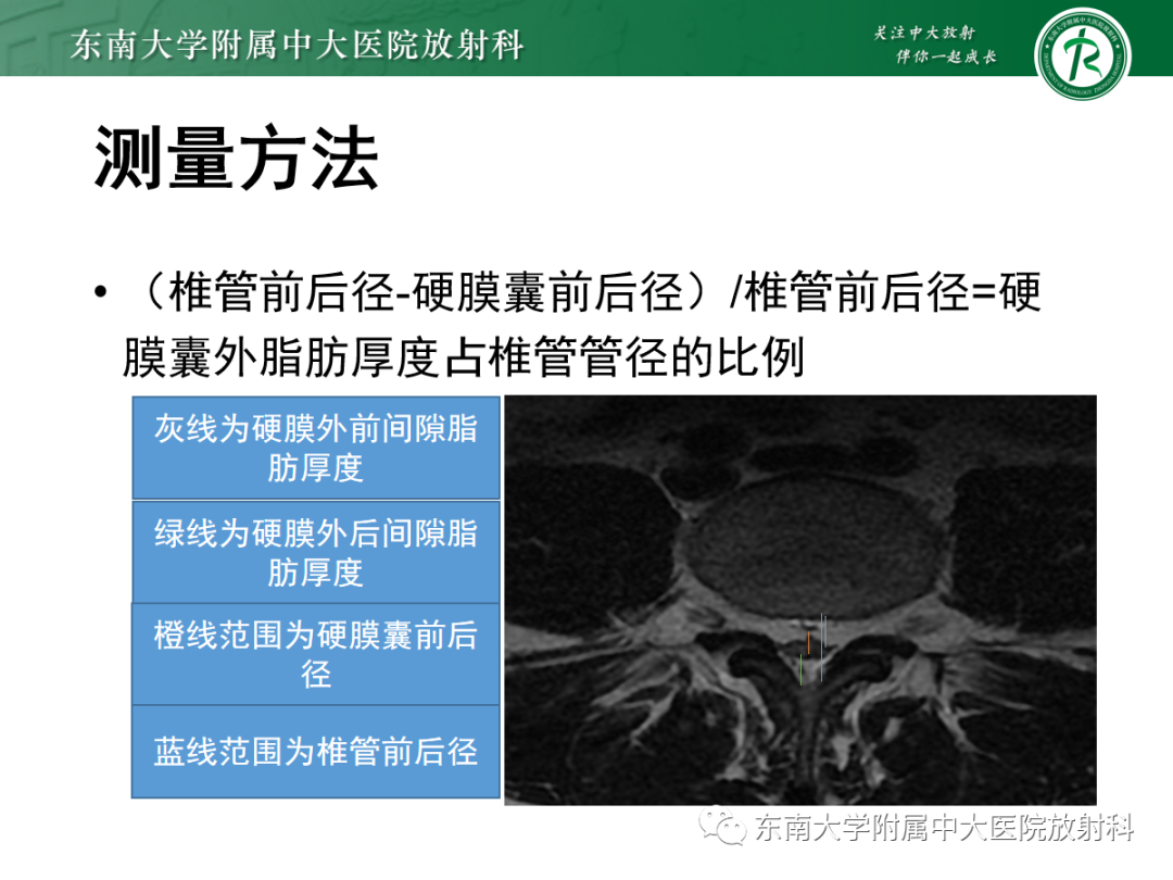 影像PPT - 【PPT】椎管内硬膜外脂肪增多症-7