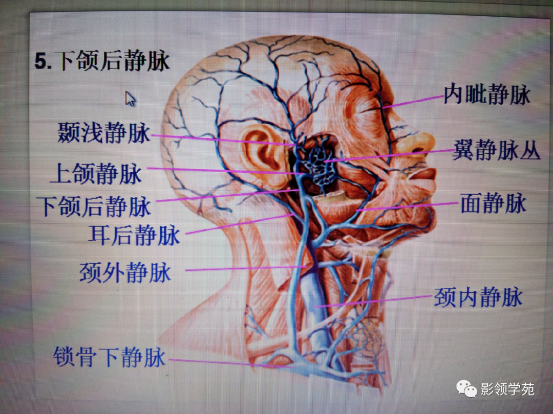 影像PPT - 腮腺及面神经解剖-8 影像PPT - 腮腺及面神经解剖-8