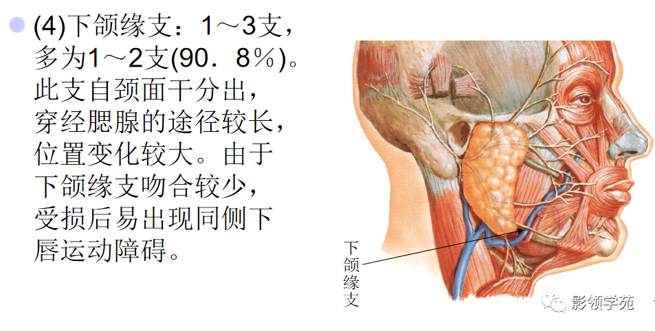 影像PPT - 腮腺及面神经解剖-14 影像PPT - 腮腺及面神经解剖-14