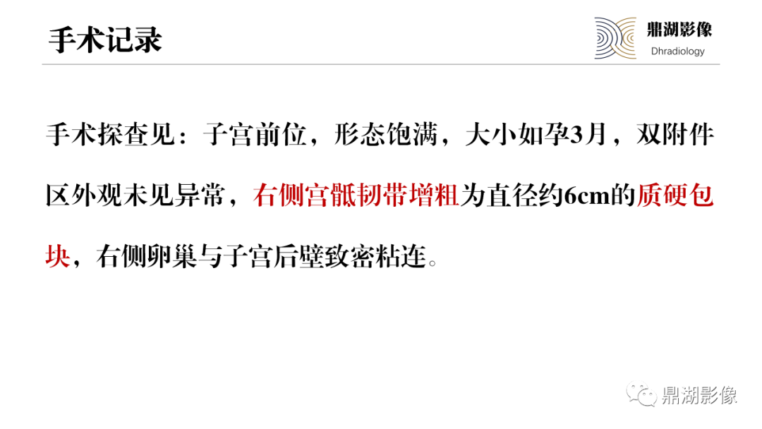 影像PPT - 【PPT】深部浸润型子宫内膜异位症诊断及鉴别-8