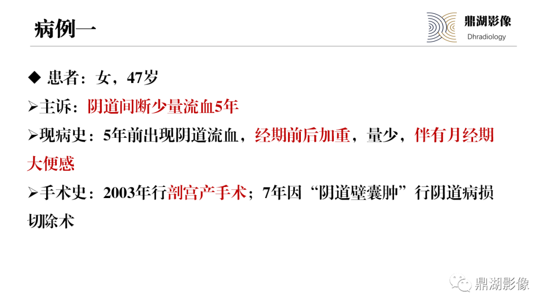 影像PPT - 【PPT】深部浸润型子宫内膜异位症诊断及鉴别-6