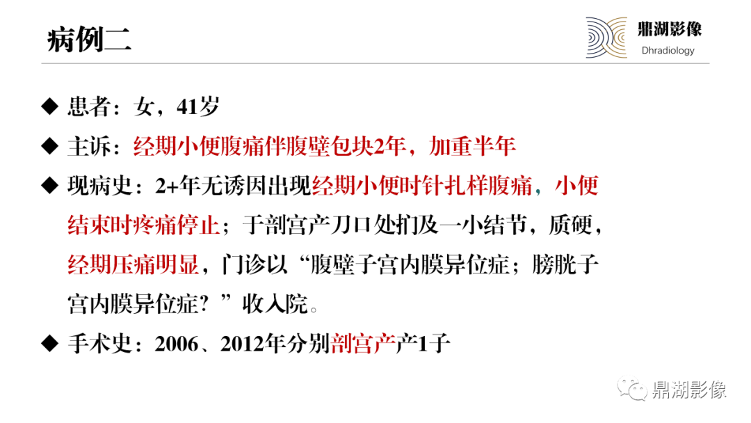 影像PPT - 【PPT】深部浸润型子宫内膜异位症诊断及鉴别-10