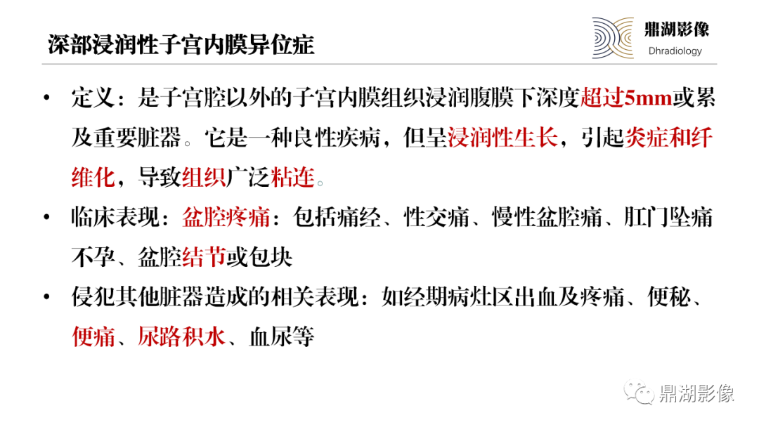 影像PPT - 【PPT】深部浸润型子宫内膜异位症诊断及鉴别-20