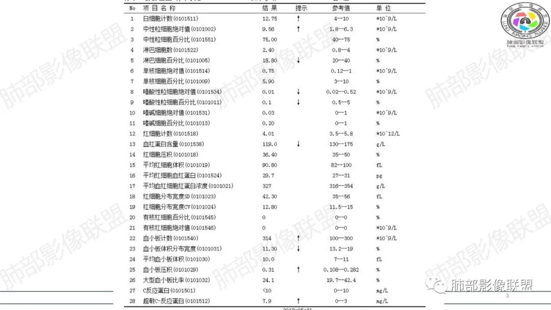 影像PPT - 【病例】来势汹汹肺包块—不典型类癌-3 影像PPT - 【病例】来势汹汹肺包块—不典型类癌-3