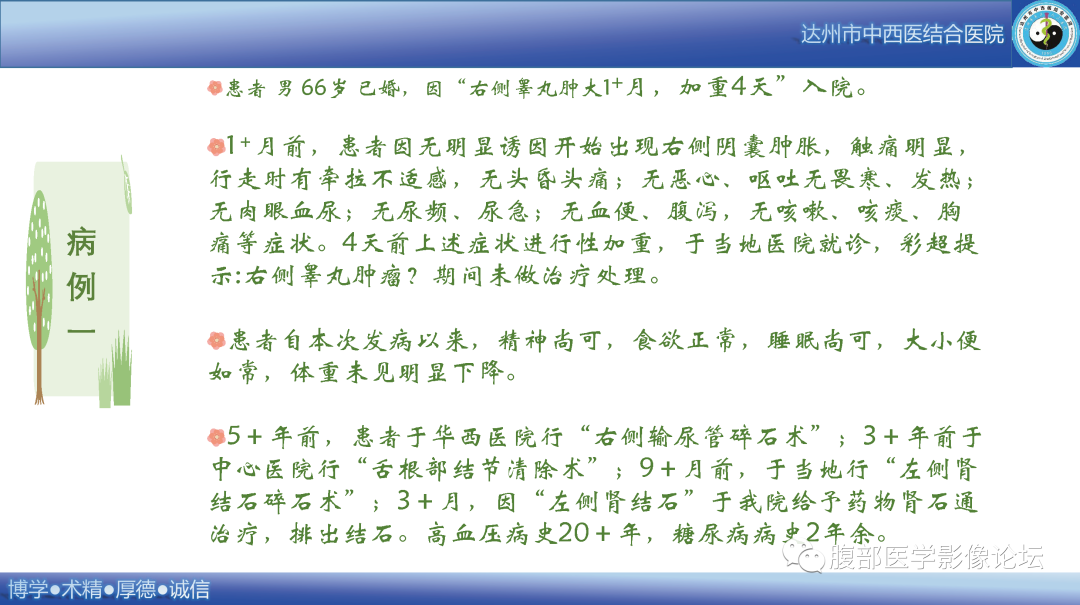 影像PPT - 【病例】睾丸淋巴瘤1例CT及MR影像-2 影像PPT - 【病例】睾丸淋巴瘤1例CT及MR影像-2