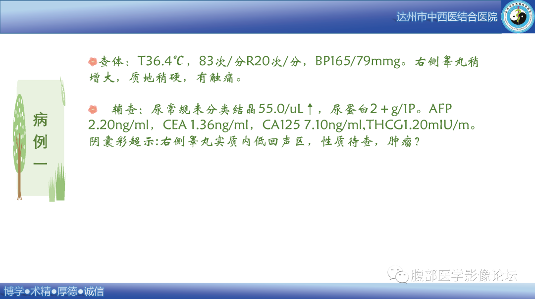 影像PPT - 【病例】睾丸淋巴瘤1例CT及MR影像-3 影像PPT - 【病例】睾丸淋巴瘤1例CT及MR影像-3