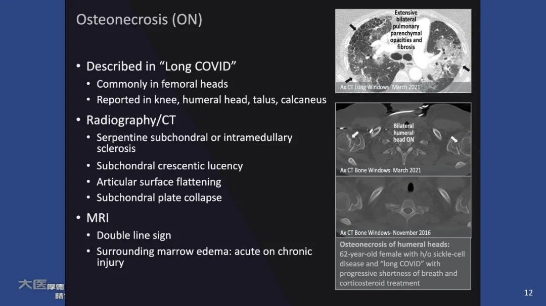 影像PPT - 【PPT】COVID-19 的肌肉骨骼表现：对目前所描述的多模态成像及临床症状的图片综述​-12