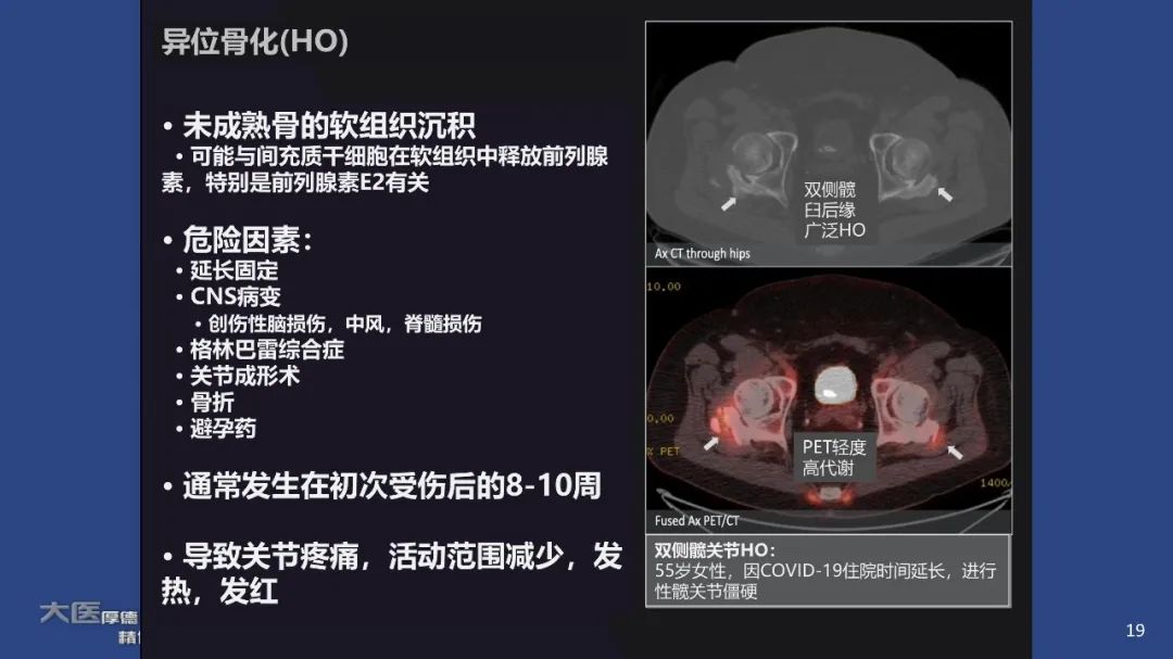 影像PPT - 【PPT】COVID-19 的肌肉骨骼表现：对目前所描述的多模态成像及临床症状的图片综述​-19