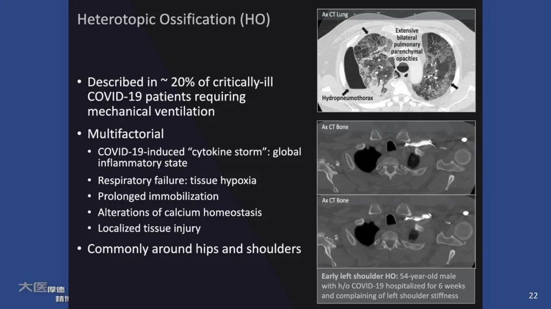 影像PPT - 【PPT】COVID-19 的肌肉骨骼表现：对目前所描述的多模态成像及临床症状的图片综述​-22