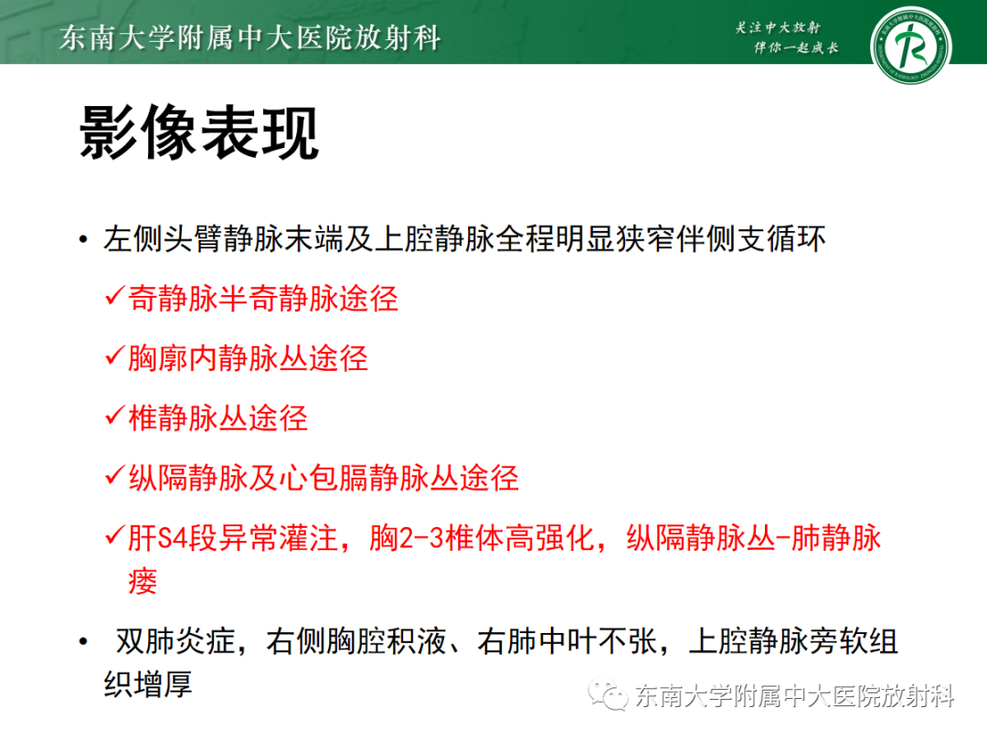 影像PPT - 【PPT】上腔静脉综合征MDCT表现-4 影像PPT - 【PPT】上腔静脉综合征MDCT表现-4