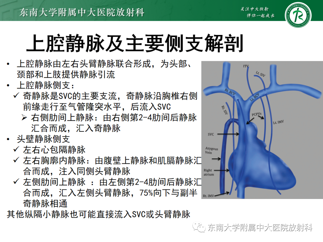影像PPT - 【PPT】上腔静脉综合征MDCT表现-12 影像PPT - 【PPT】上腔静脉综合征MDCT表现-12