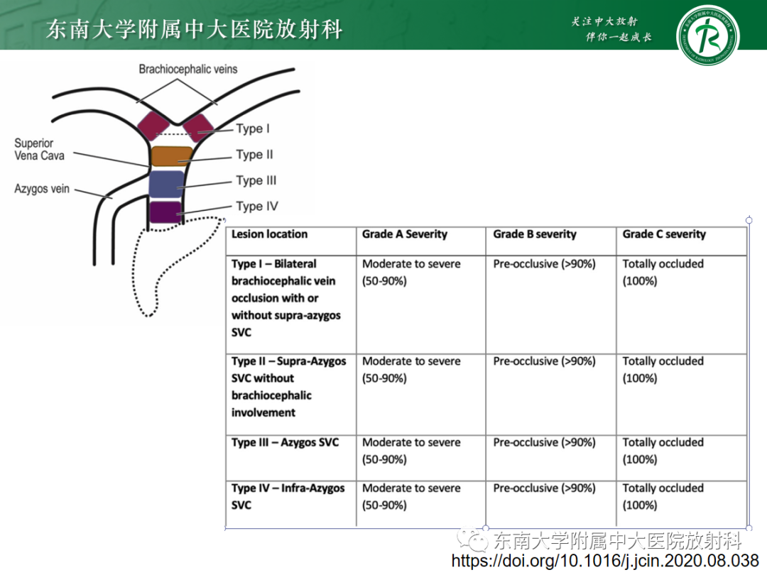 影像PPT - 【PPT】上腔静脉综合征MDCT表现-18 影像PPT - 【PPT】上腔静脉综合征MDCT表现-18