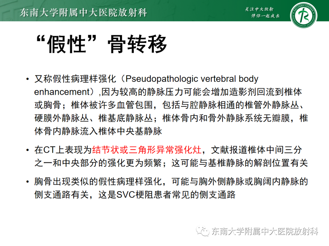 影像PPT - 【PPT】上腔静脉综合征MDCT表现-32 影像PPT - 【PPT】上腔静脉综合征MDCT表现-32