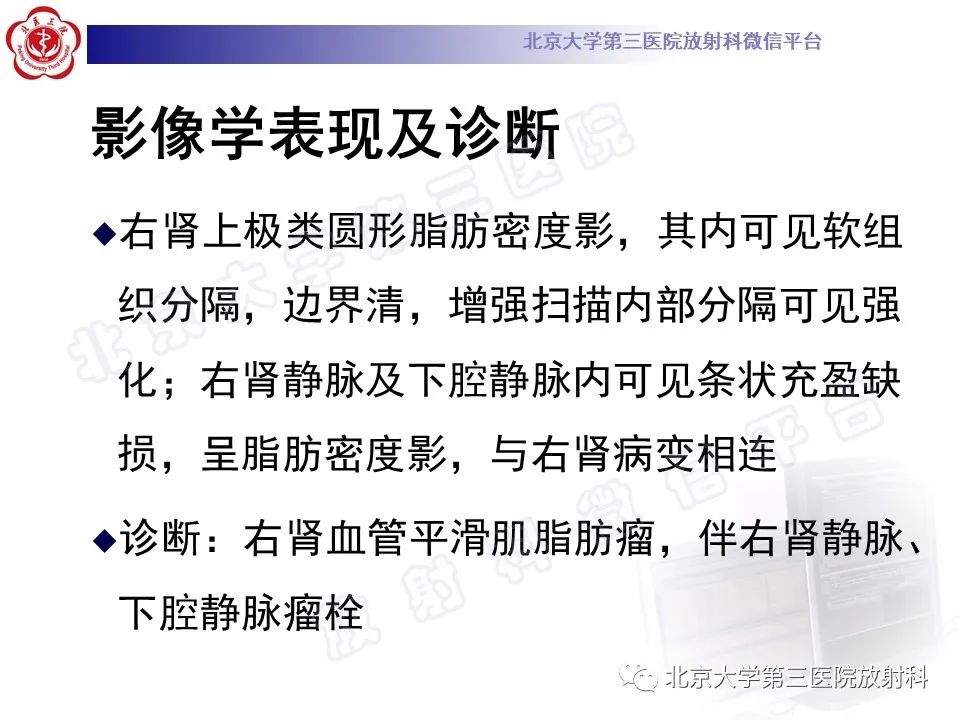 影像PPT - 【PPT】肾血管平滑肌脂肪瘤伴下腔静脉瘤栓-7