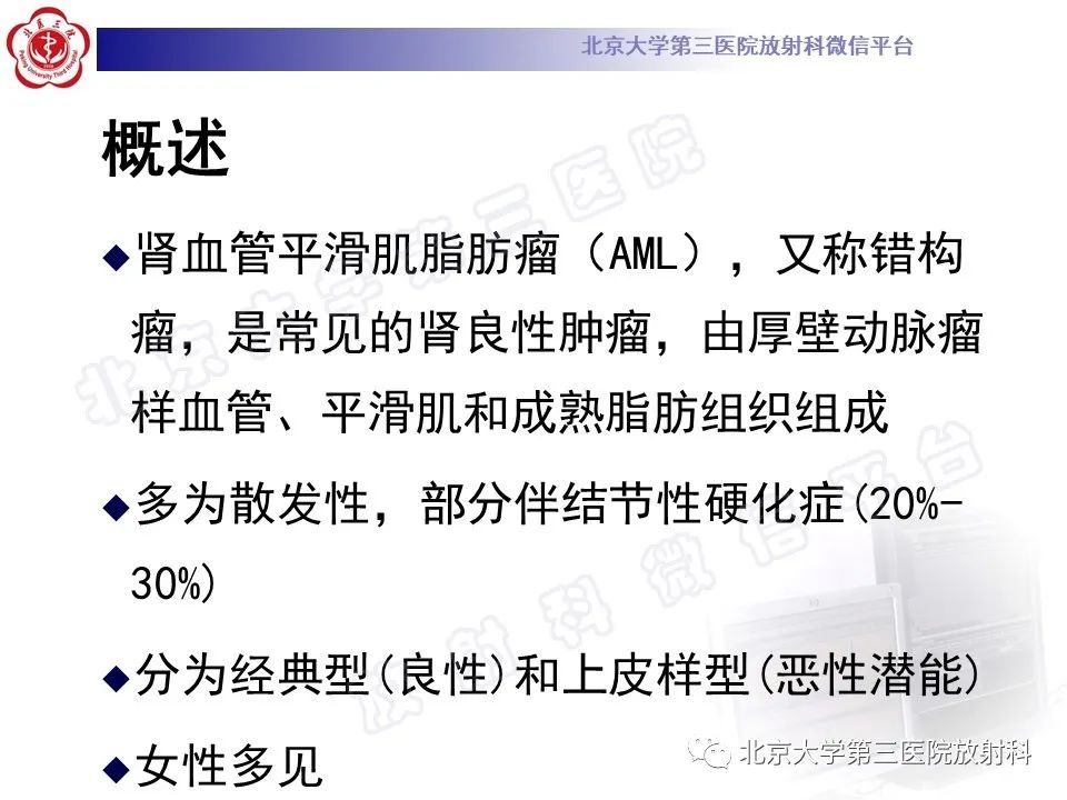 影像PPT - 【PPT】肾血管平滑肌脂肪瘤伴下腔静脉瘤栓-16