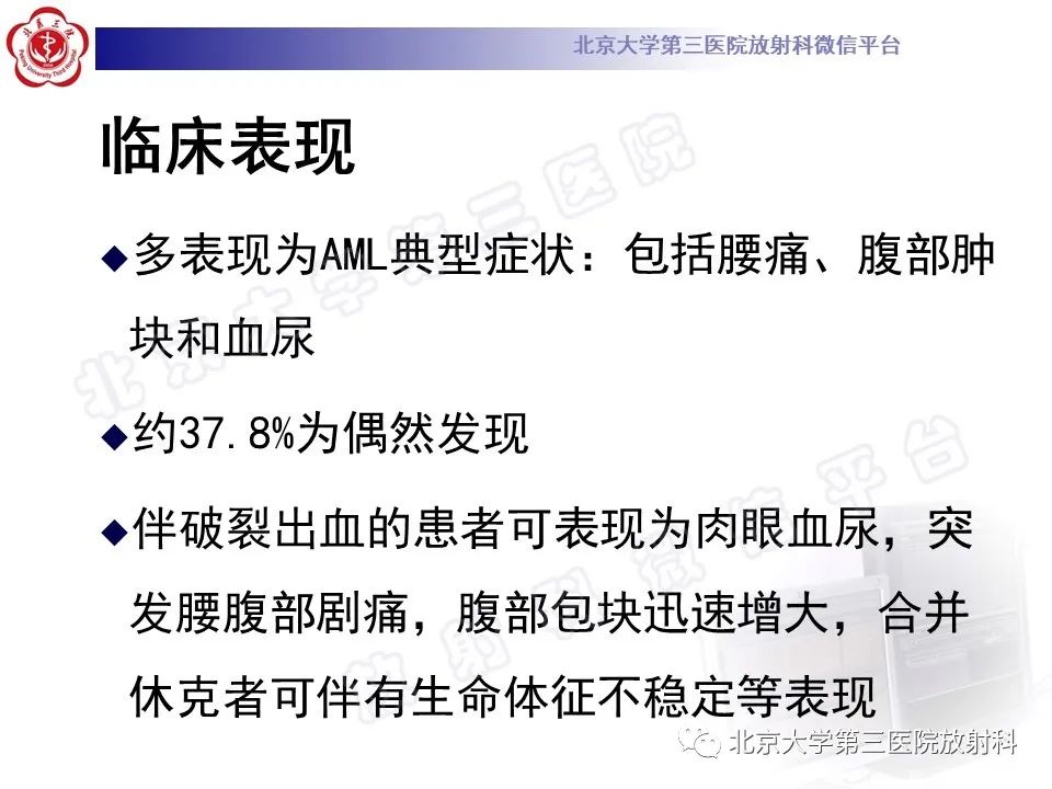 影像PPT - 【PPT】肾血管平滑肌脂肪瘤伴下腔静脉瘤栓-20