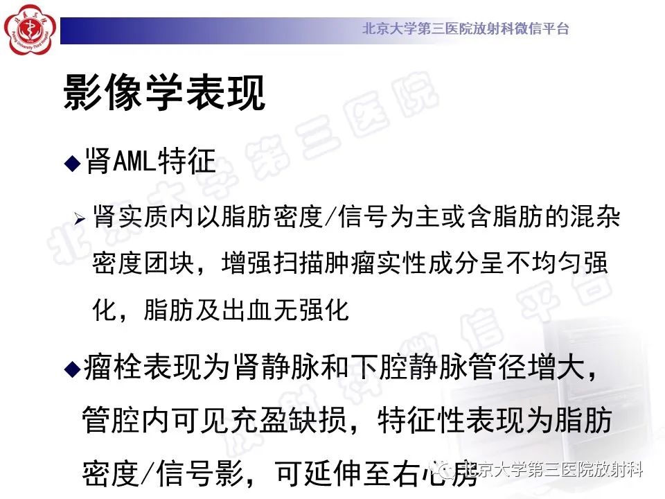 影像PPT - 【PPT】肾血管平滑肌脂肪瘤伴下腔静脉瘤栓-21