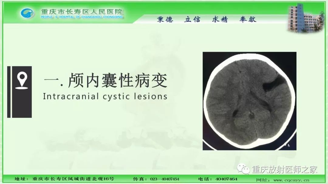 影像PPT - 【PPT】脑实质内囊性病变的MR诊断-4