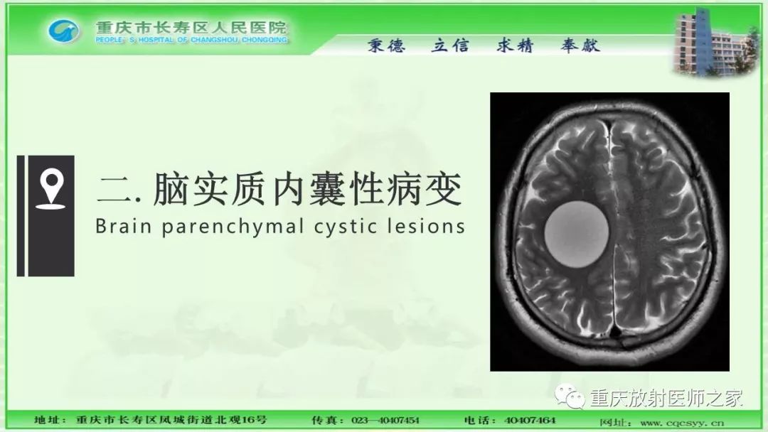 影像PPT - 【PPT】脑实质内囊性病变的MR诊断-7