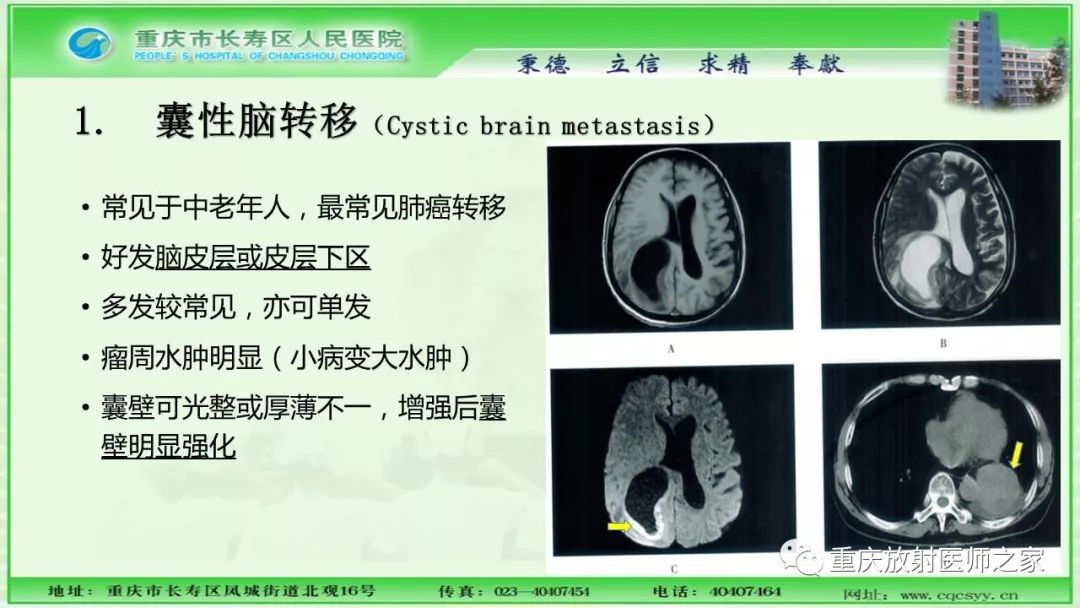 影像PPT - 【PPT】脑实质内囊性病变的MR诊断-10