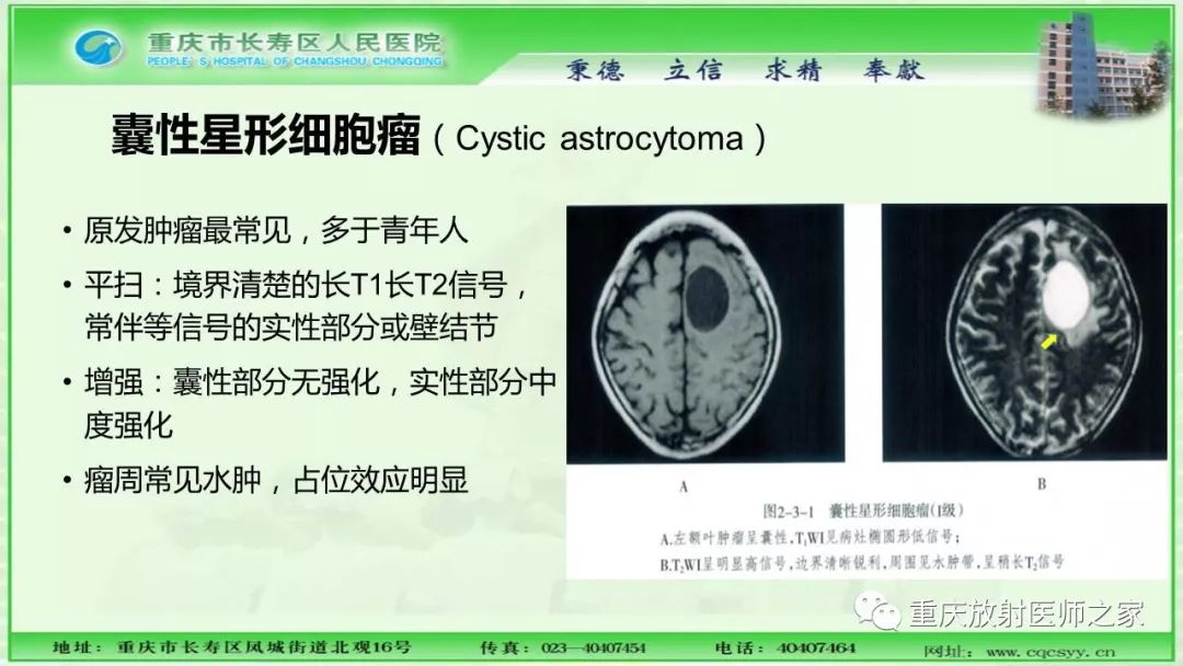 影像PPT - 【PPT】脑实质内囊性病变的MR诊断-14