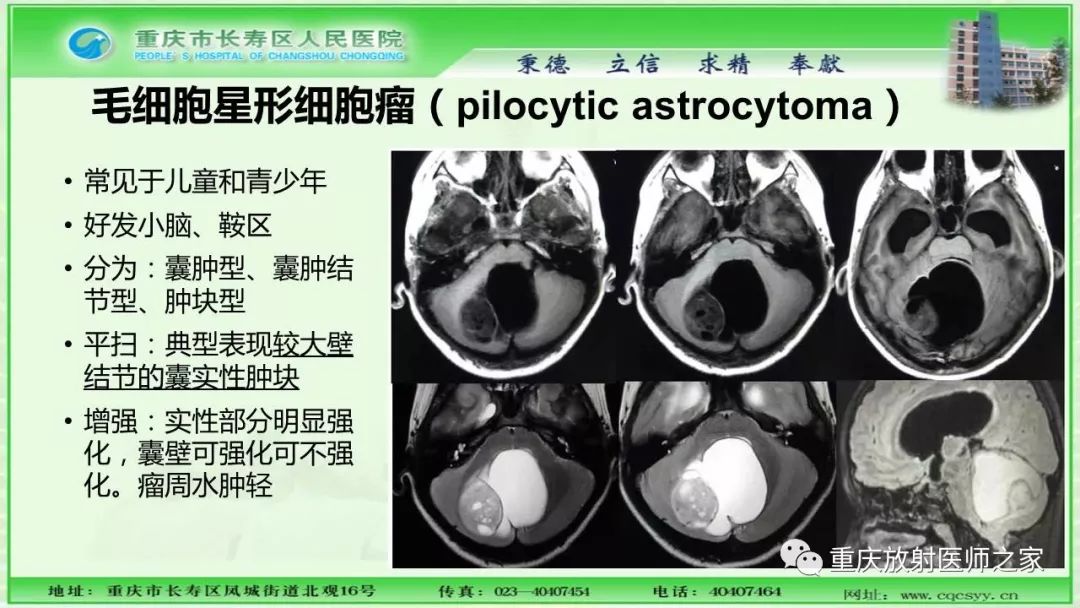 影像PPT - 【PPT】脑实质内囊性病变的MR诊断-15