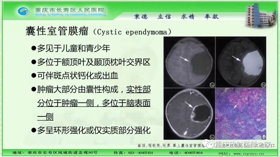 影像PPT - 【PPT】脑实质内囊性病变的MR诊断-21