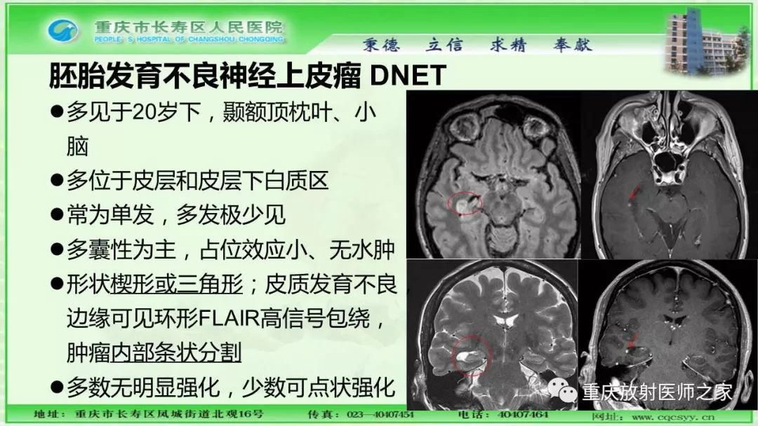 影像PPT - 【PPT】脑实质内囊性病变的MR诊断-24