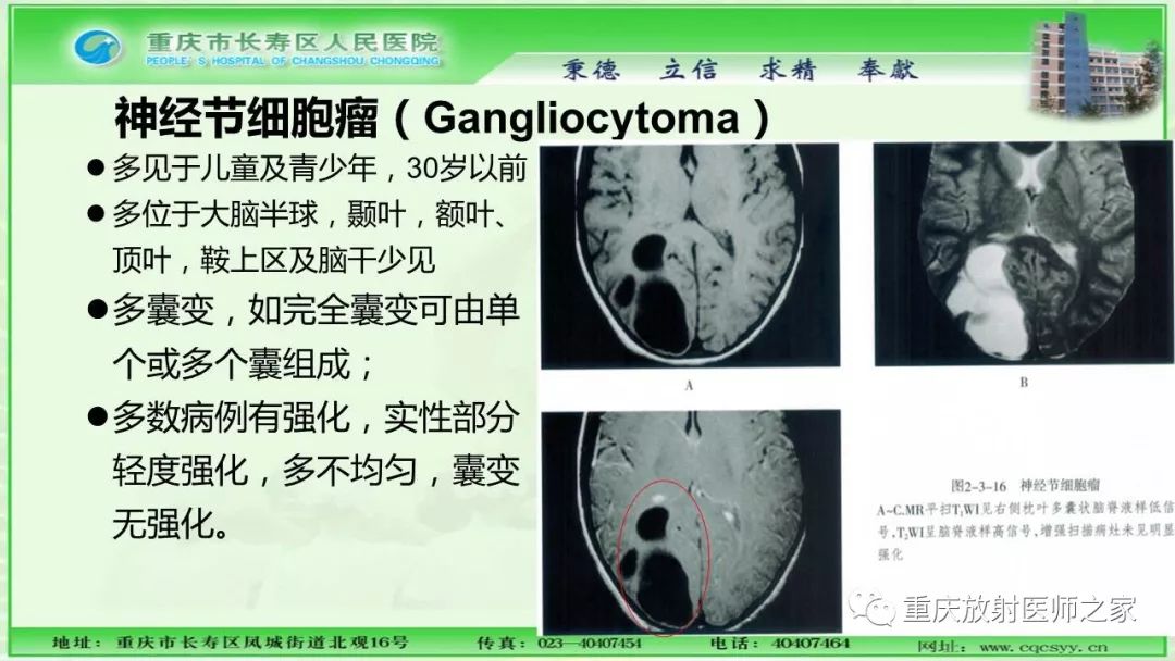 影像PPT - 【PPT】脑实质内囊性病变的MR诊断-26
