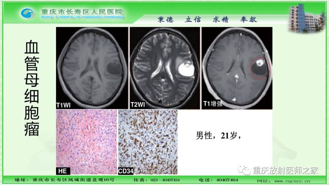 影像PPT - 【PPT】脑实质内囊性病变的MR诊断-33